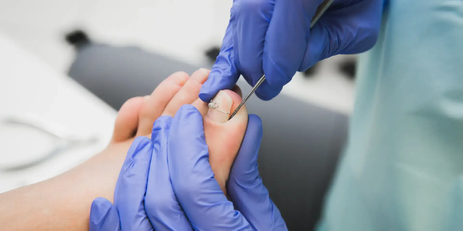 Médico en Pérez Zeledón realizando extracción de uña encarnada para aliviar el dolor del paciente.