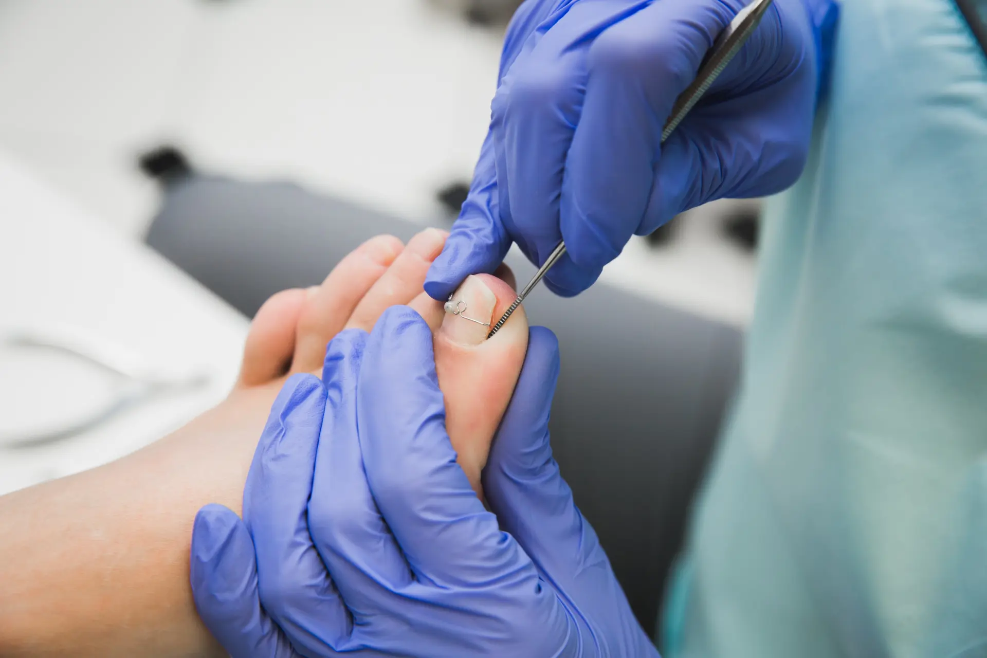 Médico en Pérez Zeledón realizando extracción de uña encarnada para aliviar el dolor del paciente.