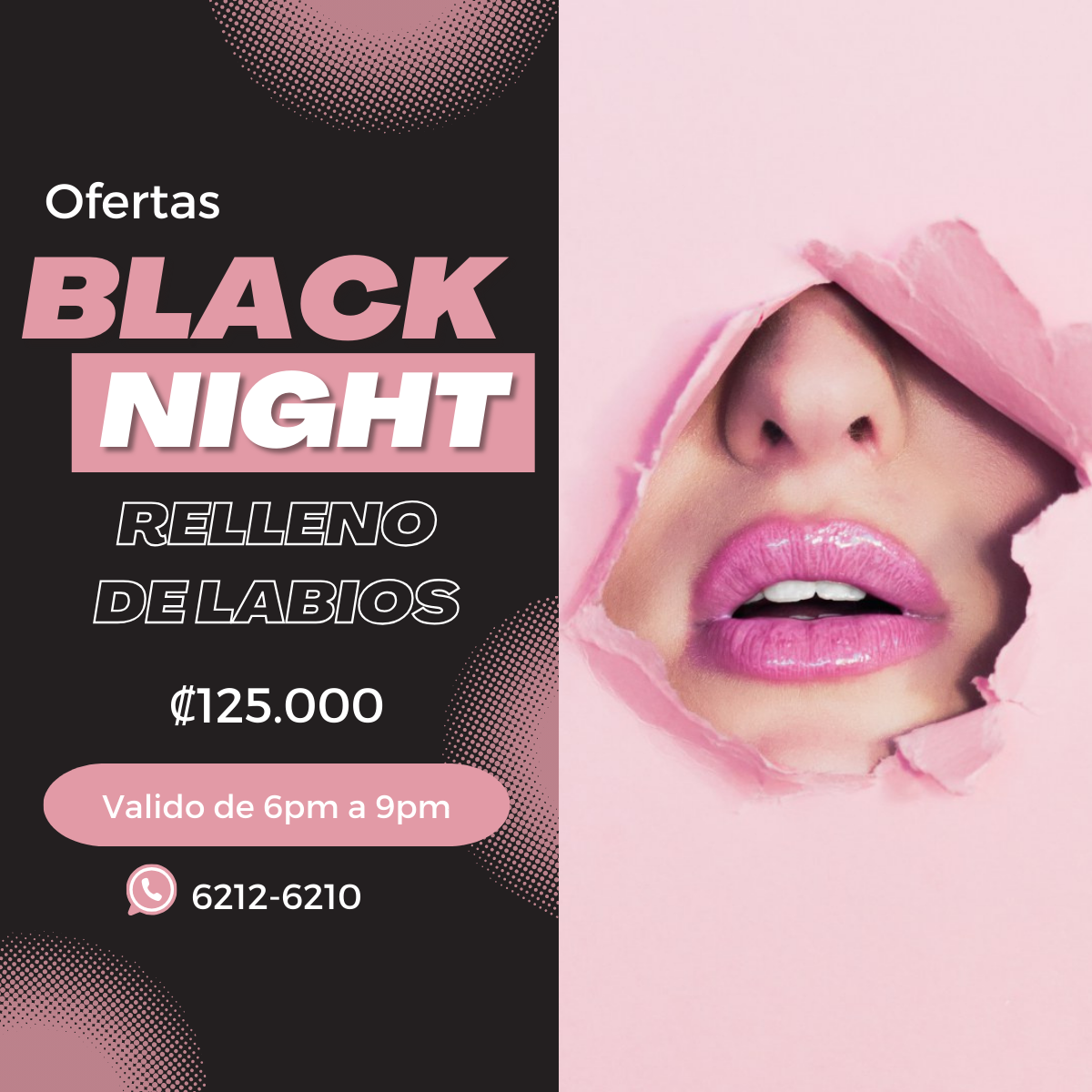 Promoción Black Night para relleno de labios a 125,000 colones, válido de 6 PM a 9 PM.