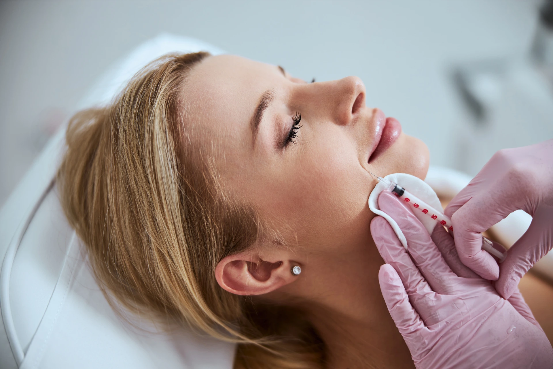 Primer plano de una mujer recibiendo inyección de ácido hialurónico en los surcos nasogenianos en una clínica estética.
