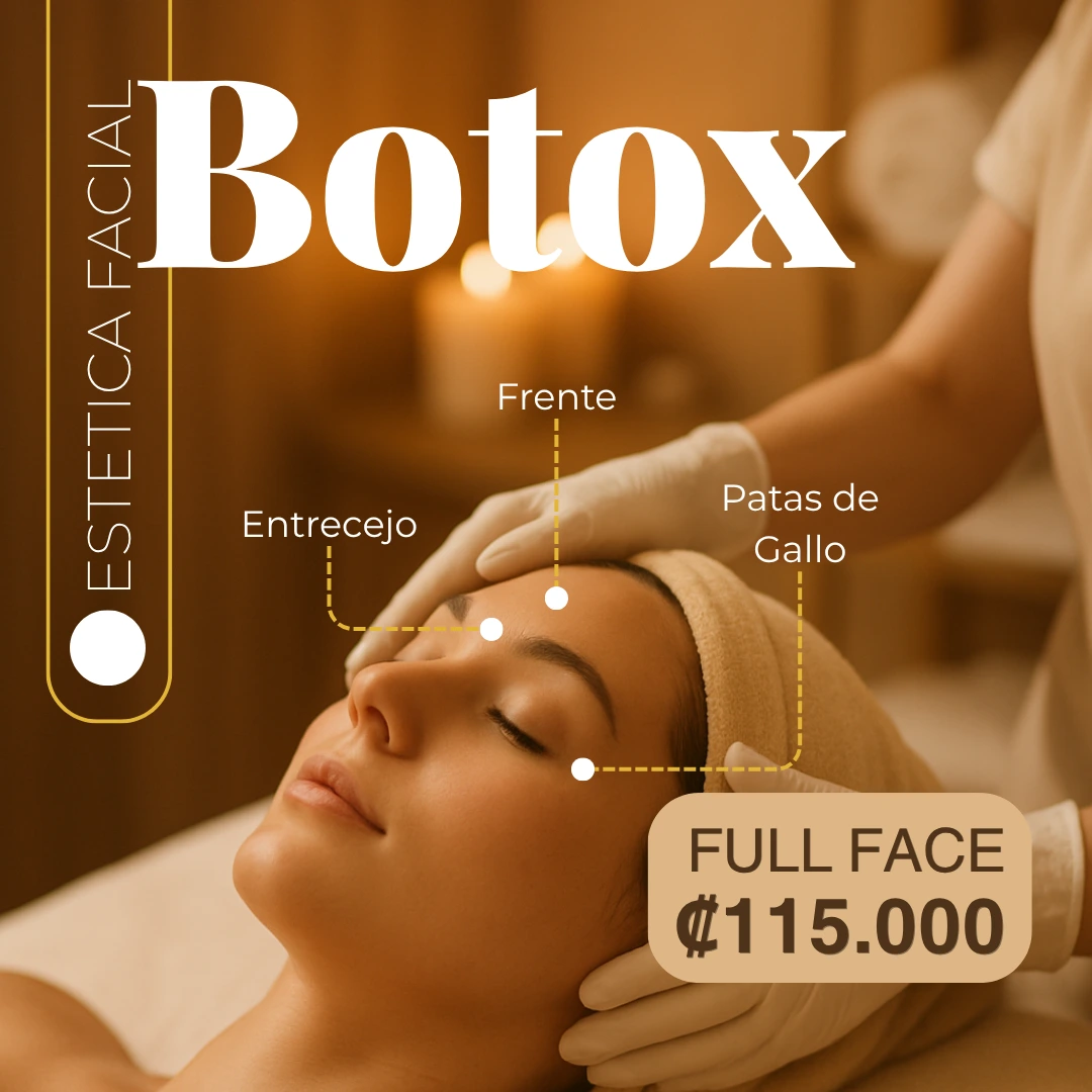Aplicación facial de botox en frente, entrecejo y patas de gallo