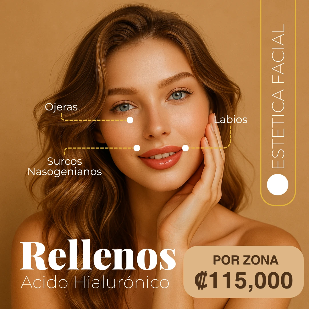 Rellenos con ácido hialurónico en labios, ojeras y surcos nasogenianos